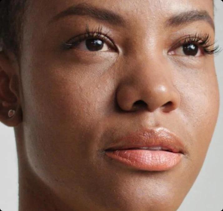 Comprehensive Metabolic Panel